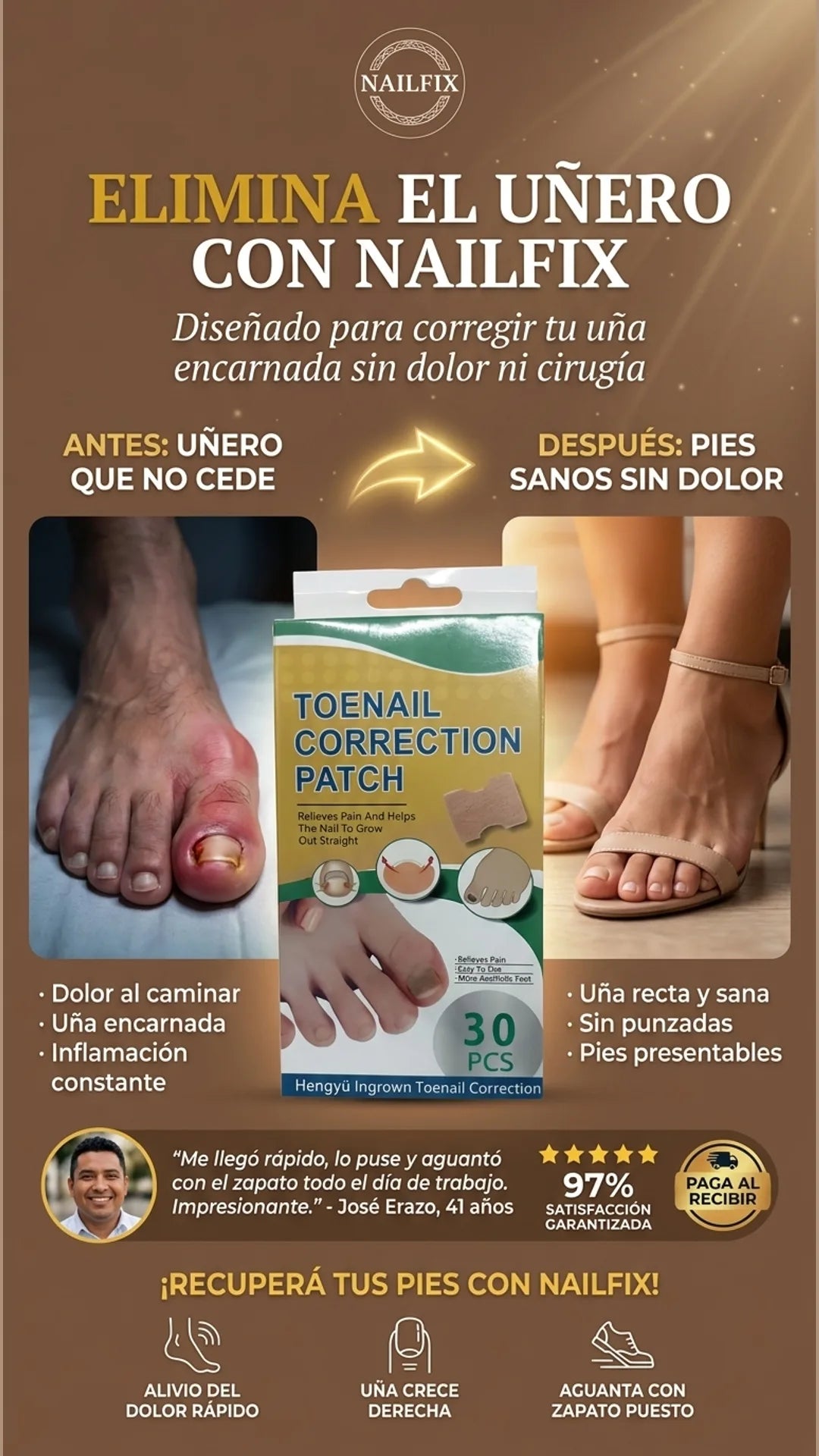 NailFix — antes-despues