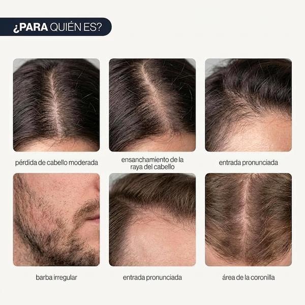Be Bodywise Suero para el crecimiento del cabello Roll On | Suero para la pérdida del cabello y el crecimiento del cabello para hombres y mujeres