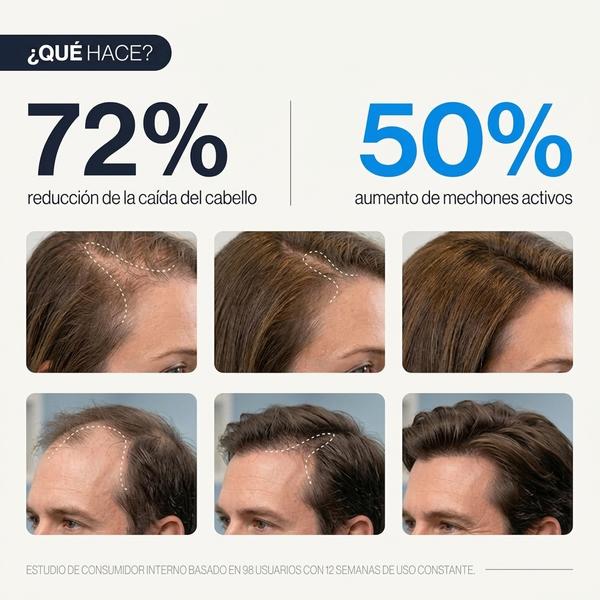 Be Bodywise Suero para el crecimiento del cabello Roll On | Suero para la pérdida del cabello y el crecimiento del cabello para hombres y mujeres