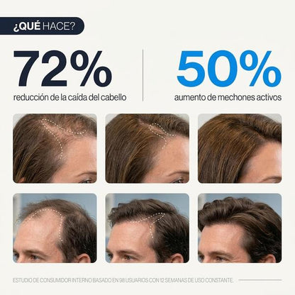 Be Bodywise Suero para el crecimiento del cabello Roll On | Suero para la pérdida del cabello y el crecimiento del cabello para hombres y mujeres