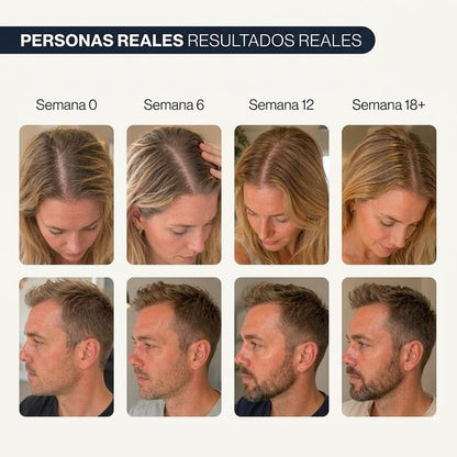 Be Bodywise Suero para el crecimiento del cabello Roll On | Suero para la pérdida del cabello y el crecimiento del cabello para hombres y mujeres